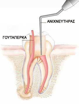 ενδοδοντική θεραπεία, απονεύρωση, ριζικοί σωλήνες, νεύρο, πολφός, αγγεία, νεύρα, νέκρωση δοντιού, απόστημα, οξύς πόνος, πόνος στο μάσημα,  τερηδόνα, ακτονογραφία, endodontiki therapeia, aponeurwsi, rizikoi swlines, neuro, polfos, neura, nekrwsi dontiou, apostima, oxis ponos, ponos sto masima,  teridona, aktinofrafia, κάταγμα δοντιούμ katagma dontiou, Τσαλιγοπούλου Ευθυμία, Λαγκαδά 130, Τηλέφωνο 2310 822572, οδοντίατρος, οδοντιατρικές υπηρεσίες, δόντια, υγεία στόματος, οδοντιατρική υγεία,  οδοντιατρείο, odontiatros, odontiatrikes upiresies, dontia, odontiatreio, odontiatriki ygeia, ygeia stomatos 